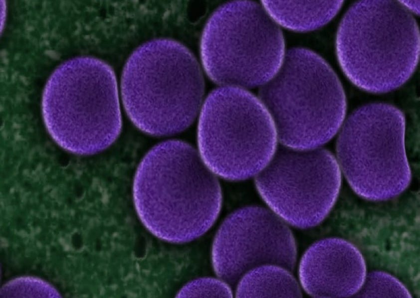 Cette image montre les avantages de l'utilisation d'Agri-Ozmoz pour une irrigation efficace et une réduction de la consommation d'eau en agriculture. Le schéma explique clairement comment les particules d'Agri-Ozmoz absorbent l'eau et la restituent ensuite aux racines de la plante, augmentant ainsi son accès à l'eau. Cette illustration démontre l'innovation et la technologie d'Agri-Ozmoz, qui contribuent à une meilleure utilisation de l'eau, tout en soutenant une croissance optimale des plantes et une agriculture plus durable, en particulier dans les zones confrontées à la sécheresse et aux difficultés d'irrigation.